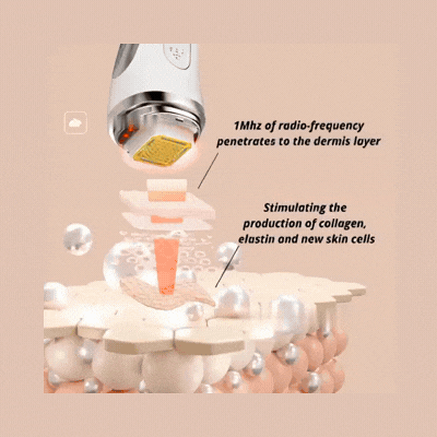 Electroporation and Pumping